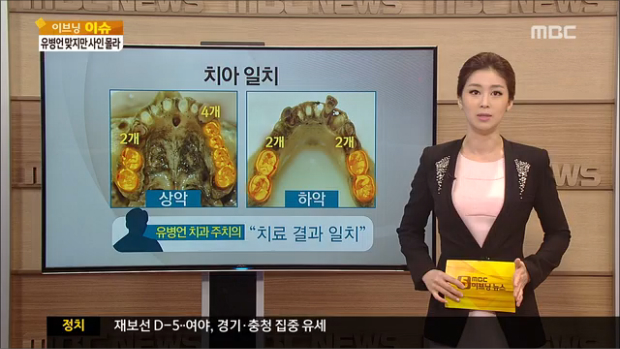 키치아결손 부위DNA 모두 일치"유병언 시신 맞다"