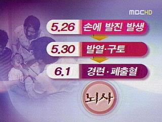 수족구병 12개월 여아 뇌사 상태감염 비상