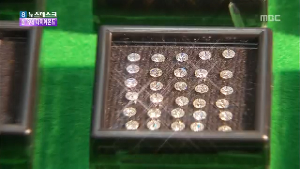 몸 속에 1천개 다이아몬드 숨겨 밀반입천억원 상당