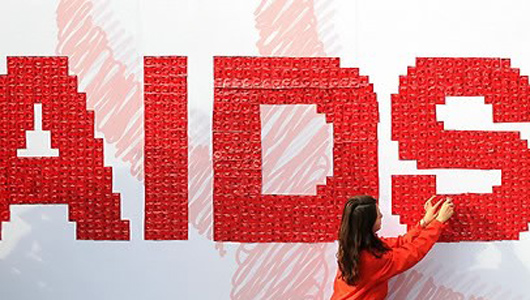 미국서 에이즈 새 치료법 개발원숭이 실험서 효과 입증