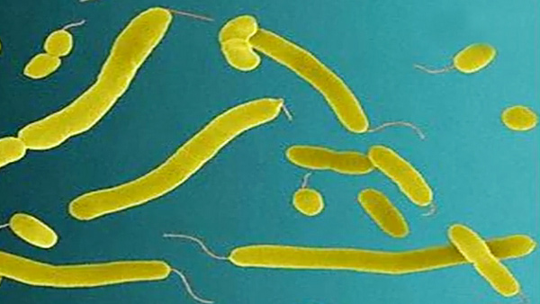 올해 첫 '비브리오패혈증' 환자 발생…예년보다 3~4개월 빨라