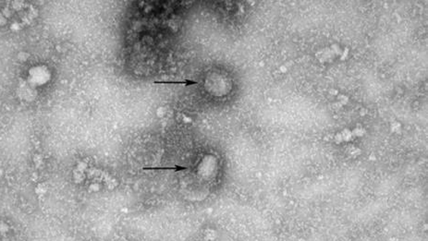 태국서 '중국 폐렴' 환자 첫 확인…