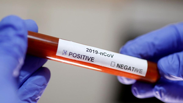 中 코로나19 백신 개발 속도…"동물 임상시험 착수"