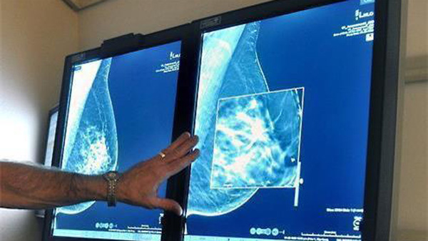日 연구진 "폐경 전 정기적 음주, 비만보다 유방암 위험 더 높여"
