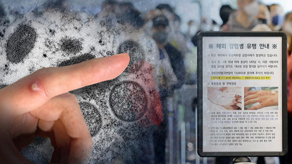 외교부 "재외국민 중 원숭이두창 감염 사례 없어…동향 주시"
