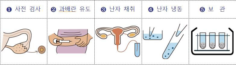 서울시, 20~40대 여성 난자동결시술 지원 대상 확대·기준 완화