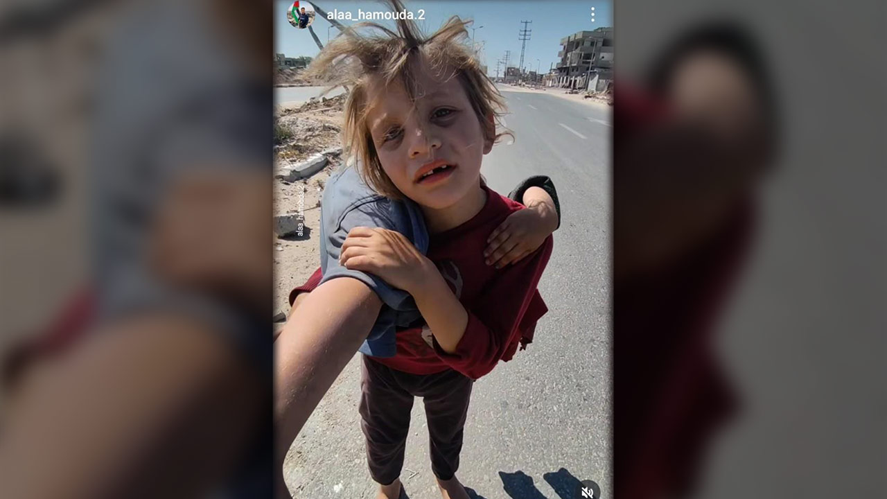 다친 동생 들쳐업은 맨발 소녀는 '6살' 카마르 수부