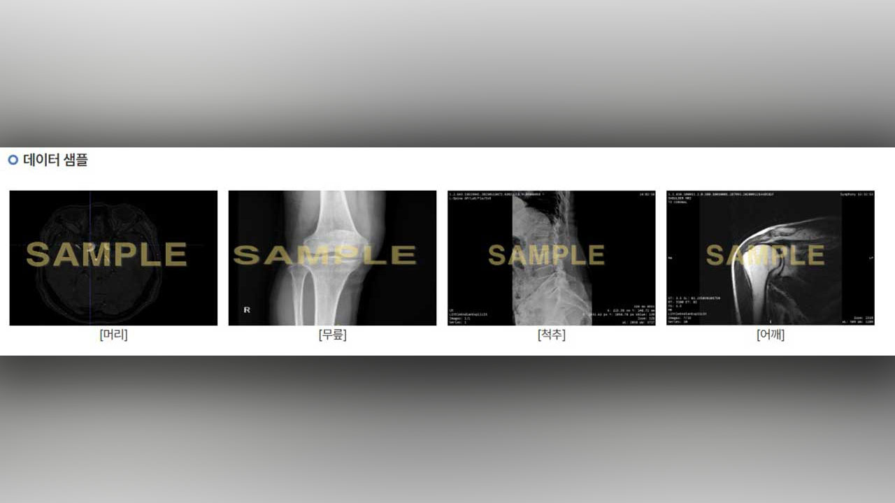 건강보험심평원, 10일부터 '비식별 처리' 영상진료 데이터 제공