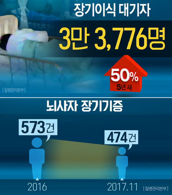 [뉴스인사이트] 원정까지 고민하는 장기이식 대기자들