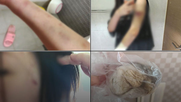 탐정M개X먹이고5시간가혹행위에도불구속기각또기각