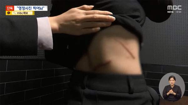 탐정M한밤의비명소리재결합거부하자전아내마구찌른현역군인