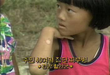 경남 함안군 주민 40여명 집단 피부병백지연