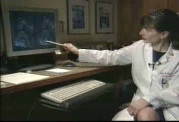 미국 태아 심장판막수술 뱃속 수술 성공