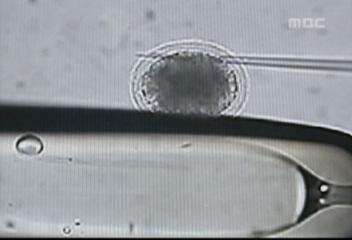 서울대 윤리위 여성 연구원 난자 의혹 조사PD수첩 채취 기록 확인금기종