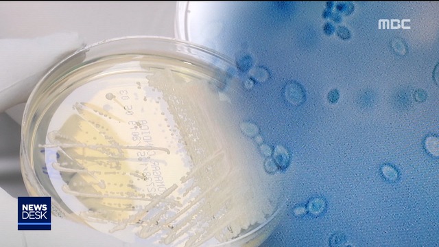 단독 항진균제 안 듣는 슈퍼곰팡이국내 2명 사망 확인
