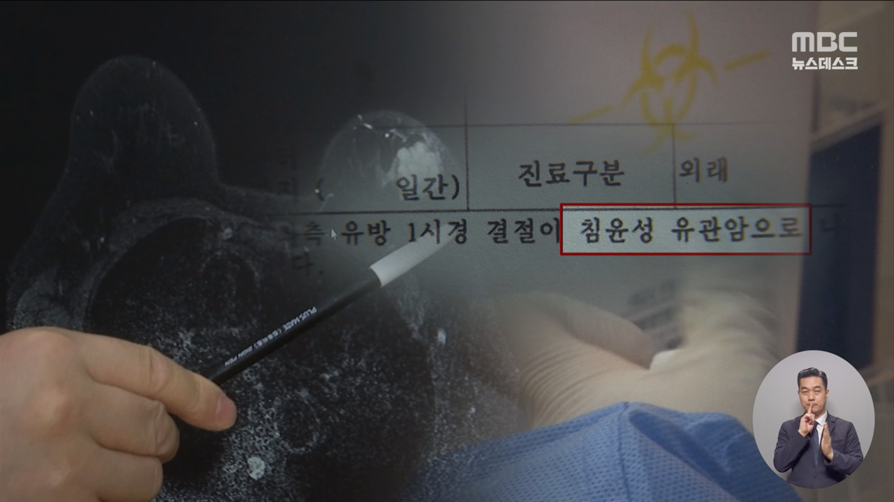 멀쩡한 사람에게 암 수술알고보니 뒤바뀐 검체