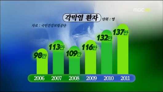 20대 각막염 급증콘택트렌즈 착용 위험