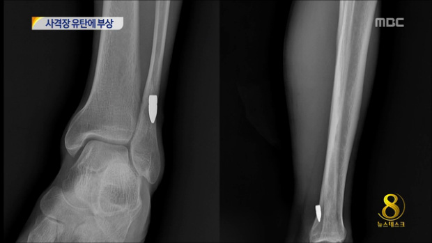 군 사격장 훈련 유탄에 민간인 발목 부상