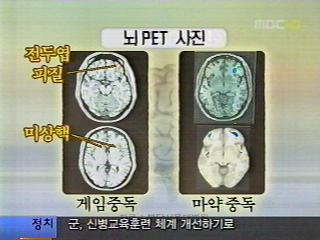게임중독마약중독과유사뇌구조변한다