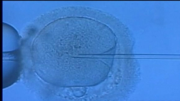 시험관아기 성공률 40세 2245세 3