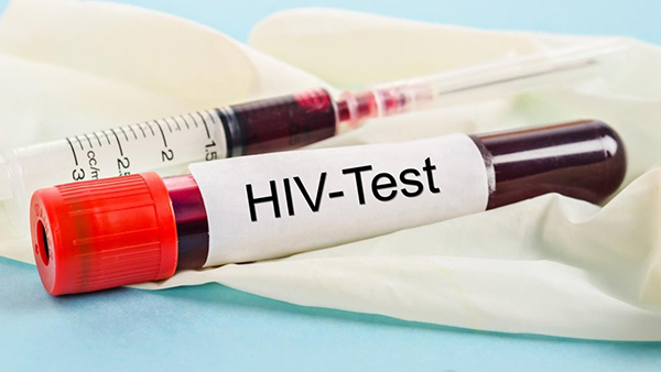  캘리포니아 에이즈 고의적으로 옮겨도 중범죄경범죄 처벌