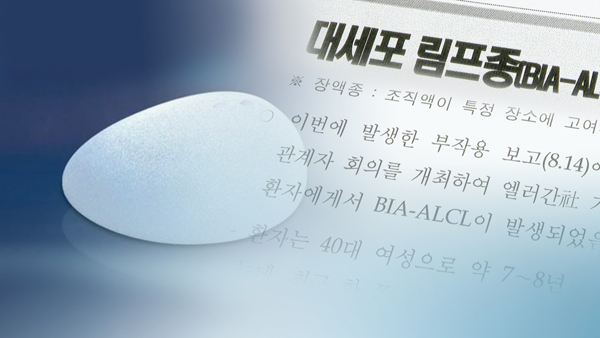 엘러간 인공바카라사이트 캡틴 이식 후 희귀암 1명 추가 발생