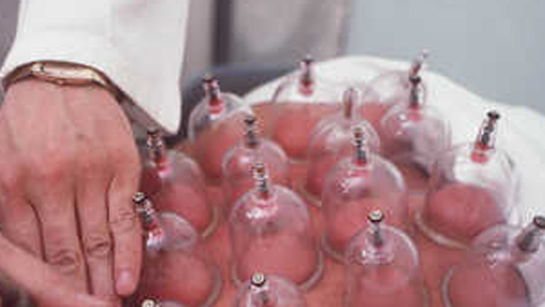 한방 '과잉치료'?…0~3세 보험금 청구 9개월간 1만2천건