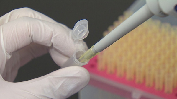 완치자 171명 혈장 모집…이르면 다음주 혈장치료제 임상시험