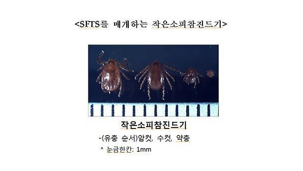 의료진 5명 '중증열성혈소판감소증후군' 양성…2차 감염 추정