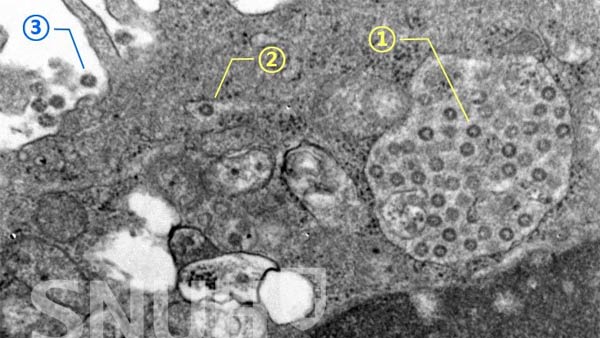 中 연구팀 "코로나19 이미 변이 일으켜…2종류 아류형 발현"