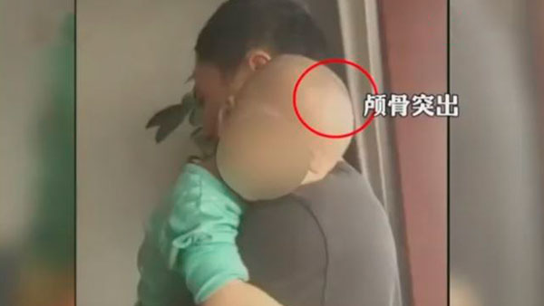 [World Now] "몸에 좋다더니 머리만 커져?" 가짜분유에 뒤집힌 중국