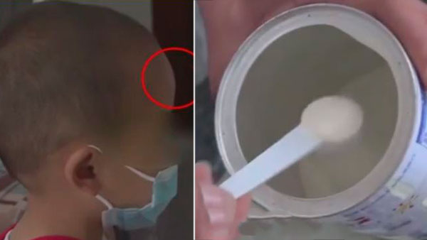 [World Now] "몸에 좋다더니 머리만 커져?" 가짜분유에 뒤집힌 중국