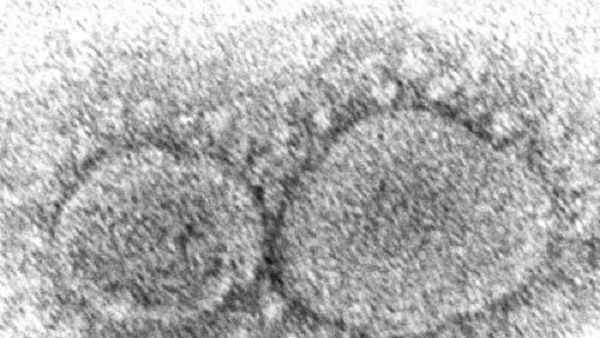 "코로나19 백신, 접종자 바이러스 전파력 떨어뜨려"