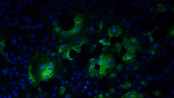 日 도쿄대 연구팀 "코로나 항체 3∼6개월 유지"