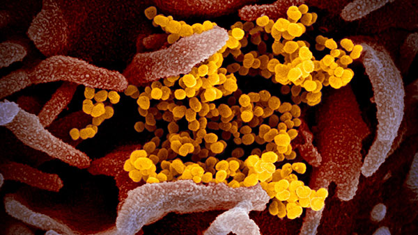 미 정보당국 "코로나19, 생물학무기는 아냐"