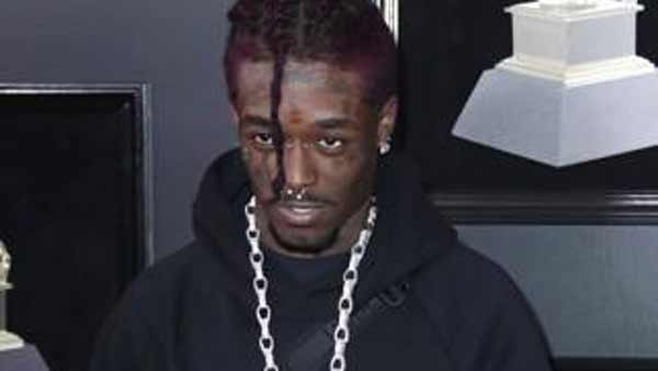 [World Now] 이마에 박은 '277억 다이아'…"공연 중 팬이 잡아 뜯어"