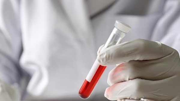 코로나19 기원 밝혀질까?..중국, 우한 혈액 샘플 수천 개 검사