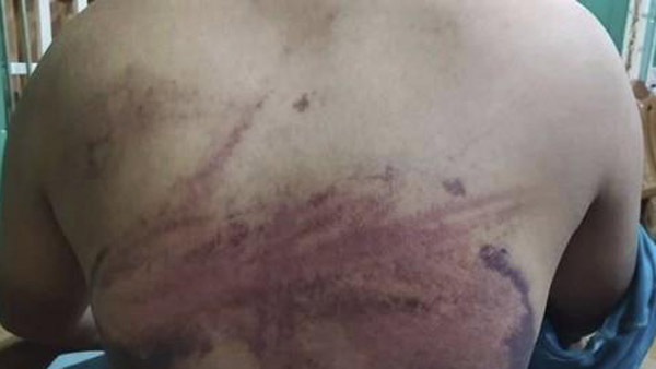 美 국무부, 미얀마 군부 고문에 우려‥"긴급 조사 요구"