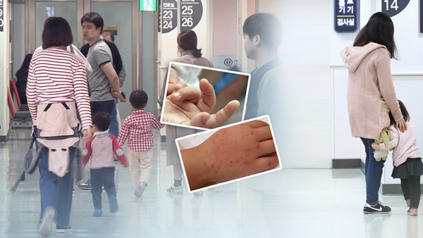 영유아 수족구 다시 증가‥"의심땐 접촉자제"