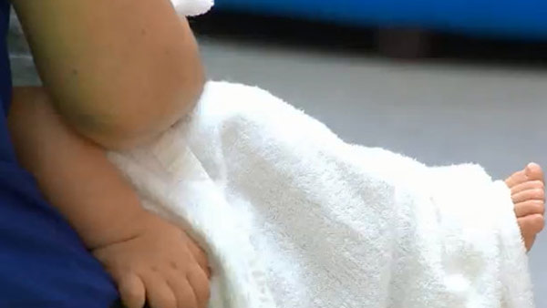 영유아 수족구 환자 2주새 2.3배 급증‥"아이 위생 유의해야"