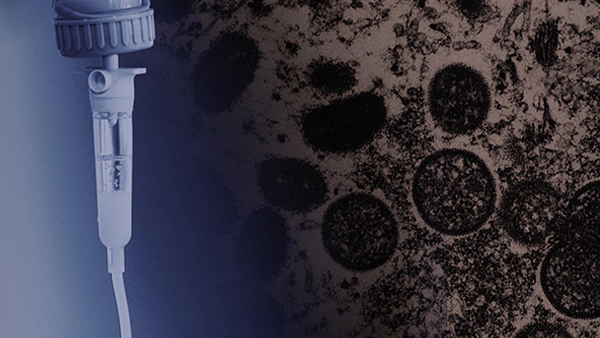 엠폭스 환자 2명 추가발생‥모두 국내 감염 추정