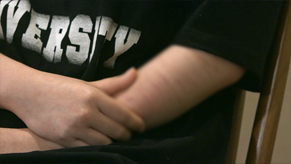 [PD수첩] 누가 그들을 죽음으로 내모는가? 우울증 갤러리의 실체