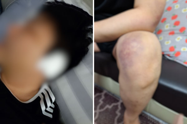 [단독] '공포의 학원'‥강사 10달 동안 폭행하며 돈 뜯어낸 원장 구속 송치