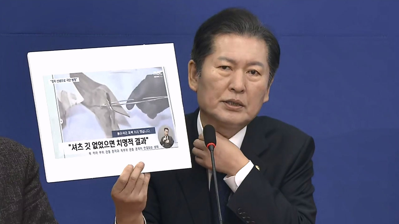 민주당 "이재명 살인미수 부실 수사‥배후 밝히고 재수사해야"