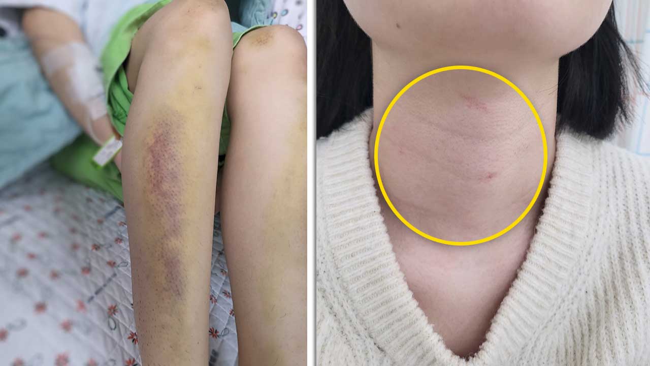 '거제 교제폭력' 가해자 구속영장 신청‥"폭행으로 사망했을 가능성 높아"