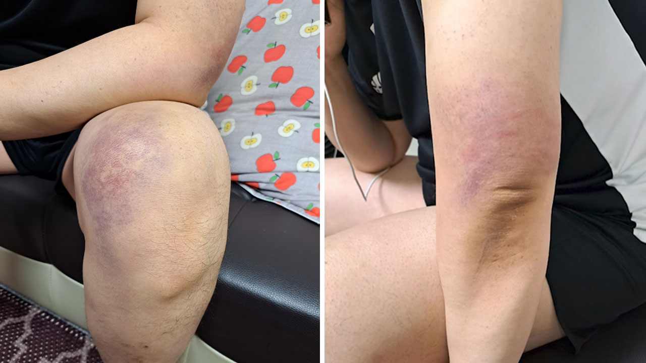 학원강사 때리고 신체포기 각서 쓰게 한 학원원장 징역 4년 선고 