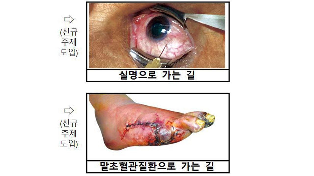 '폐암으로 가는 길' 담뱃갑 새 건강무료 바카라사이트 문구·그림 내일부터 적용