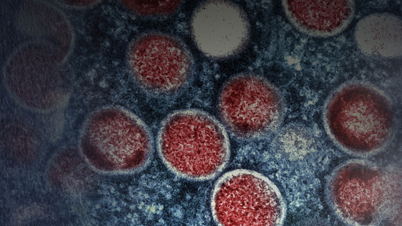 필리핀서 올해 첫 엠폭스 환자 발생‥"변종 여부 분석 중"