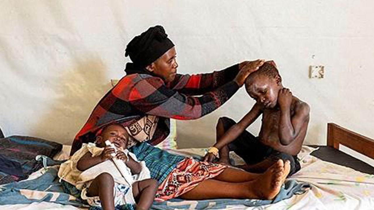 아프리카 대륙 올해 엠폭스 의심사례 2만 5천 건 육박