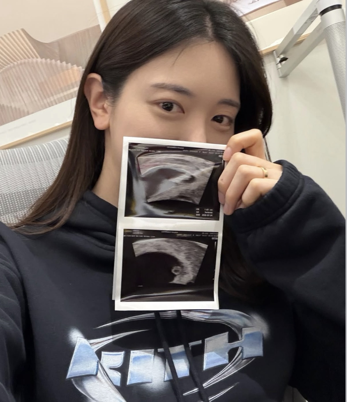 유혜주 둘째 임신 관련 보도 이미지